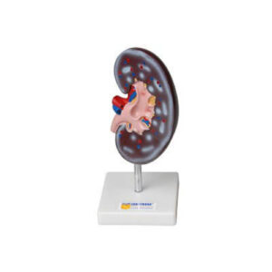 Модель почки в разрезе