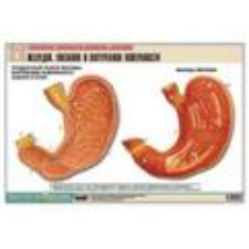 Рельефная таблица "Желудок. Внешняя и внутренняя поверхности" (формат А1, матовое ламинир.) Рельефная таблица "Желудок. Внешняя и внутренняя поверхности" (формат А1, матовое ламинир.)