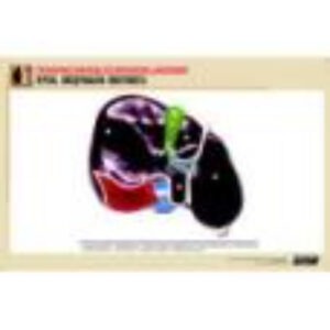 Рельефная таблица "Печень. Висцеральная поверхность" (формат А1, матовое ламинир.)